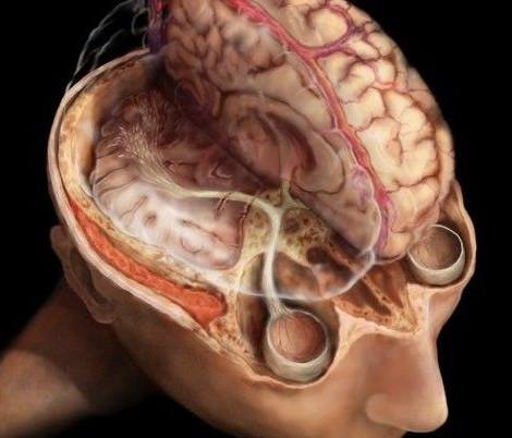 Οπτική οδός: Η διαδρομή ανάμεσα στον οφθαλμό και στον ανθρώπινο εγκέφαλο